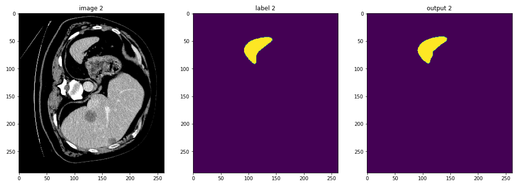 Original output as single slice of from each volume